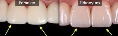 Çorlu, Zirkonyum Kaplama mı Porselen Kaplama mı?  Dt. Esra Polat -  AQUA Dental Çorlu / Diş Hekimi
